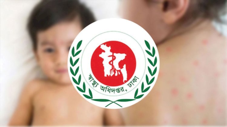হাম ও উপসর্গে ২৪ ঘণ্টায় আরও ১৩ শিশুর মৃত্যু